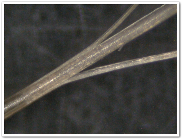 顕微鏡写真 おヒゲが枝毛 かみうさぎ